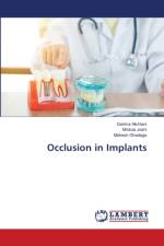 Occlusion in Implants af Nichlani Garima Nichlani
