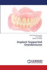 Implant Supported Overdentures af Ghadage Mahesh Ghadage