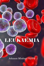 Leukaemia af Johnson Mbabazi