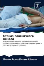 Стеноз поясничного канала af х