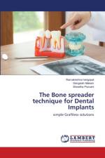 Bone spreader technique for Dental Implants af Ramakrishna Harigopal