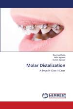 Molar Distalization af Soumya Gupta