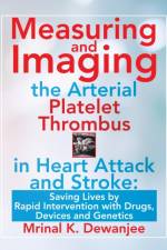 Measuring and Imaging the Arterial Platelet Thrombus in Heart Attack and Stroke af Mrinal K Dewanjee