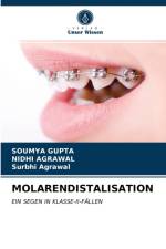Molarendistalisation af Soumya Gupta