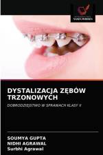 Dystalizacja ZĘbow Trzonowych af Soumya Gupta