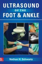 Ultrasound of the Foot and Ankle af Nathan Schwartz