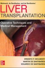 Liver Transplantation: Operative Techniques and Medical Management af Ernesto P. Molmenti