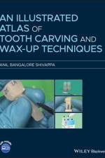 An Illustrated Atlas of Tooth Carving and Wax-Up Techniques af Anil Bangalore Shivappa