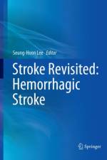 Stroke Revisited: Hemorrhagic Stroke