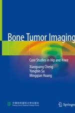 Bone Tumor Imaging af Xiaoguang Cheng