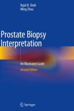 Prostate Biopsy Interpretation af Rajal B. Shah