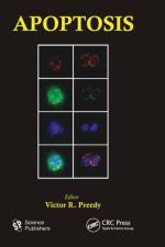 Apoptosis
