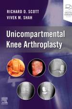 Unicompartmental Knee Arthroplasty af Richard D. Scott