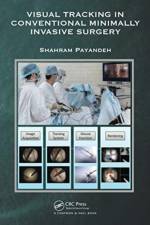 Visual Tracking in Conventional Minimally Invasive Surgery af Shahram Payandeh