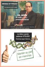 dieta cuando padeces VITILIGO! af Jose Moya