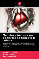 Metodos nao-invasivos de fibrose na hepatite B cronica af Sonda Jardak