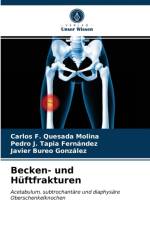 Becken- und Huftfrakturen af Carlos F Quesada Molina