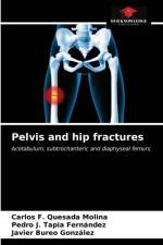 Pelvis and hip fractures af Carlos F Quesada Molina