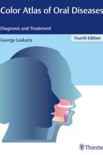 Color Atlas of Oral Diseases