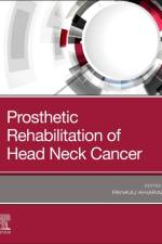 Prosthetic Rehabilitation of Head and Neck Cancer Patients
