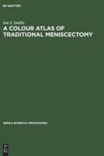 Colour Atlas of Traditional Meniscectomy af Ian S Smillie
