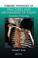 Forensic Pathology of Fractures and Mechanisms of Injury af Michael P. Burke