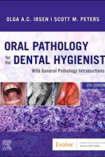Oral Pathology for the Dental Hygienist af Olga A. C. (Adjunct Professor<br>Department of Oral and Maxillofacial Pathology Ibsen