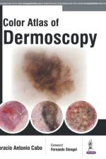 Color Atlas of Dermoscopy af Horacio Cabo