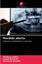 Mordida aberta af Darshana Mundhe