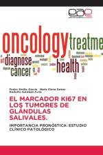 Marcador Ki67 En Los Tumores de Glandulas Salivales. af Rodolfo Esteban Avila