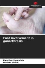 Foot involvement in gonarthrosis af Kaouther Maatallah