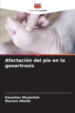 Afectacion del pie en la gonartrosis af Kaouther Maatallah