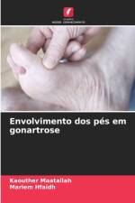 Envolvimento dos pes em gonartrose af Kaouther Maatallah