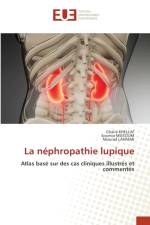 nephropathie lupique af Mourad Lahmar