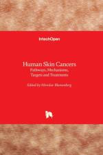Human Skin Cancers