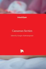 Caesarean Section