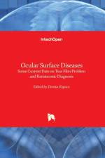 Ocular Surface Diseases