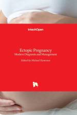 Ectopic Pregnancy af MICHAEL KAMRAVA