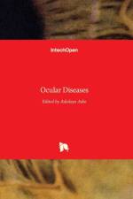 Ocular Diseases af ADEDAYO ADIO