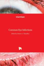 Common Eye Infections af IMTIAZ CHAUDHRY