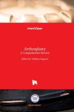 Arthroplasty af VAIBHAV BAGARIA