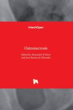 Osteonecrosis af ALESSANDRO RO ZORZI