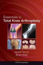 Essentials in Total Knee Arthroplasty af Javad Parvizi