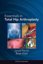 Essentials in Total Hip Arthroplasty af Javad Parvizi