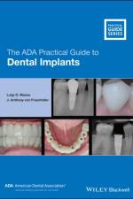 The ADA Practical Guide to Dental Implants af Luigi O. (Premier Dental Center Massa