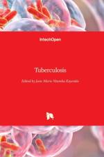 Tuberculosis