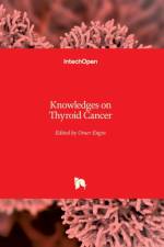 Knowledges on Thyroid Cancer