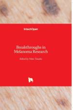 Breakthroughs in Melanoma Research