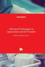 Advanced Techniques in Liposuction and Fat Transfer af NIKOLAY SERDEV