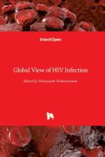 Global View of HIV Infection
